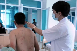 Bệnh nhân bị ong rừng đốt. Ảnh minh họa. (Ảnh: Nguyễn Công Hải/TTXVN)
