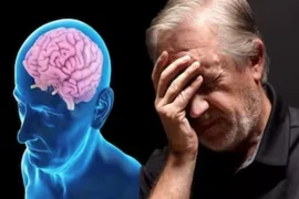 Bệnh Alzheimer. (Nguồn: thehealthsite)