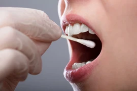 Ảnh minh họa. (Nguồn: Dental Health)