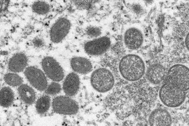 Hình ảnh virus đậu mùa khỉ dưới kính hiển vi điện tử. (Ảnh: AFP/TTXVN)