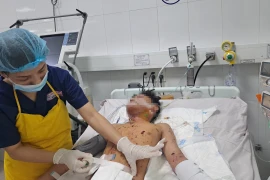 Bệnh nhân bị chấn thương do pháo nổ. (Ảnh: TTXVN phát)