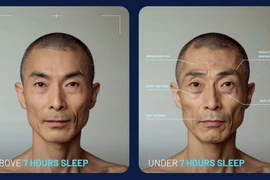 Hình ảnh AI mô phỏng diện mạo của một người khi ngủ đủ 7 giờ mỗi đêm (trái) và khi bị thiếu ngủ (phải). (Nguồn: Simba Sleep)