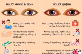 [Infographics] Cách phòng tránh lây lan của bệnh đau mắt đỏ