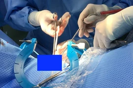 (Ảnh minh họa: TTXVN phát)