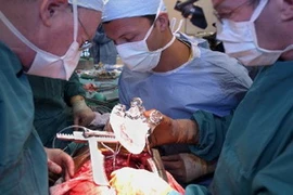 Ảnh minh họa. (Nguồn: Internet)