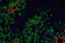 Ảnh chỉ có tính minh họa. (Nguồn: med.stanford.edu)