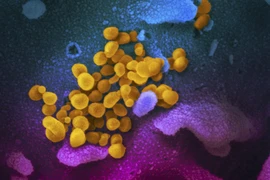 Hình ảnh do Viện nghiên cứu y tế quốc gia cung cấp cho thấy hình ảnh virus SARS-CoV-2 (màu vàng) gây dịch viêm đường hô hấp cấp COVID-19 nổi lên trên bề mặt tế bào (màu xanh, hồng) của một bệnh nhân COVID-19 ở Mỹ. (Ảnh: AFP/TTXVN)
