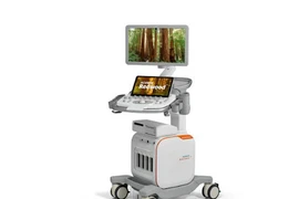 Siemens Healthineers ra mắt hệ thống siêu âm với chi phí hiệu quả