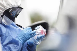 Nhân viên y tế lấy mẫu dịch xét nghiệm COVID-19 cho người dân tại Bogota, Colombia. (Ảnh: THX/TTXVN)