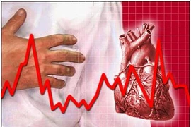 WHO ghi nhận thành tích của các chuyên gia tim mạch Séc