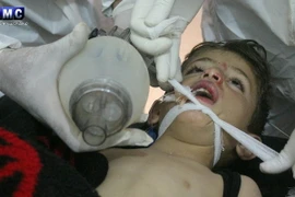 Trẻ em bị nhiễm khí độc trong vụ tấn công tại thị trấn Khan Sheikhoun được điều trị trong một bệnh viện ở Idlib, miền bắc Syria ngày 4/4. (Nguồn: EPA/TTXVN)