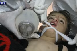 Trẻ em bị nhiễm khí độc trong vụ tấn công tại thị trấn Khan Sheikhoun được điều trị trong một bệnh viện ở Idlib, miền bắc Syria ngày 4/4. (Nguồn: EPA/TTXVN)