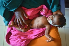 Chăm sóc trẻ em Somalia bị suy dinh dưỡng tại bệnh viện địa phương ở thị trấn Baidoa, thủ phủ vùng Bay, miền tây nam Somalia ngày 15/3. (Nguồn: AFP/TTXVN)