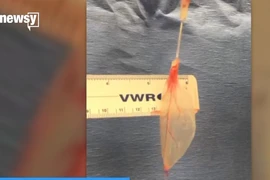 [Video] Khoa học kỳ diệu: Nuôi cấy thành công mô tim từ rau cải bó xôi