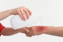 Ảnh chỉ có tính minh họa. (Nguồn: Internet)