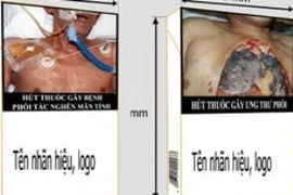 Hai mẫu hình dự kiến được in trên vỏ thuốc lá vào tháng 5 tới. (Ảnh: Healthbridge)