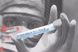 Mẫu bệnh phẩm của bệnh nhân COVID-19. (Ảnh: IRNA/TTXVN)