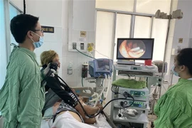 Bệnh nhân được can thiệp nội soi đại tràng nút mạch. (Ảnh: TTXVN)