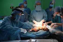 Bác sỹ Bệnh viện Nhi đồng 1 Thành phố Hồ Chí Minh phẫu thuật tách rời 2 bé gái song sinh dính bụng ngày 2/10. (Ảnh: TTXVN)