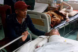 Đắk Nông: Để đèn dầu trong màn, hai mẹ con bị bỏng nặng 