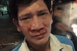 Anh Nguyễn Văn Sinh bị hành hung. (Ảnh Mạnh Khánh/TTXVN)