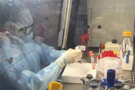 Xét nghiệm các mẫu bệnh phẩm nghi ngờ nhiễm virus SARS-CoV-2. (Ảnh: Xuân Tư/TTXVN)