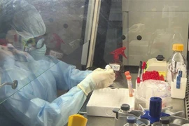 Xét nghiệm các mẫu bệnh phẩm nghi ngờ nhiễm virus SARS-CoV-2. (Ảnh: Xuân Tư/TTXVN)