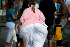 Một người bị mắc bệnh béo phì tại Maryland. (Nguồn: AFP/TTXVN)