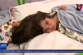 [Video] Phẫu thuật thành công tách cặp song sinh dính đầu