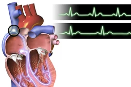 Ảnh minh họa. (Nguồn: wikimedia.org)