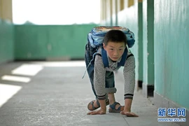 [Photo] Nghị lực chiến đấu với bệnh tật của "cậu bé ốc sên"