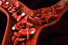 Ảnh minh họa. (Nguồn: drugtargetreview.com) 