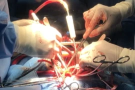 Cận cảnh ca phẫu thuật thành công cho bệnh nhân u tim hiếm gặp