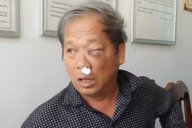 Nhà báo Hoàng Đình Chiểu, phóng viên Đài truyền hình Việt Nam bị hành hung khi đang tác nghiệp. (Nguồn: VTV.vn)