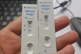 Kết quả xét nghiệm COVID-19. (Nguồn: Vietnam+)