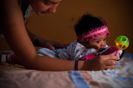 Một em bé bị mắc chứng đầu nhỏ tại thủ đô Quito, Ecuador, ngày 27/2. (Nguồn: THX/TTXVN)