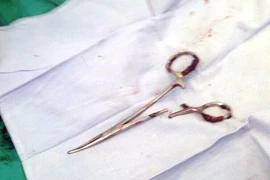 Chiếc panh han rỉ được lấy ra từ người ông Ma Văn Nhật. (Ảnh: TTXVN)