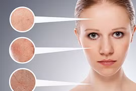 Bài nhập môn dành cho người mới bắt đầu chăm sóc da mặt