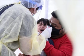 Nhân viên y tế lấy mẫu xét nghiệm COVID-19 tại Compton, California, Mỹ. (Ảnh: AFP/TTXVN)