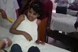 Bé gái có hành động như loài khỉ. (Nguồn: Independent)