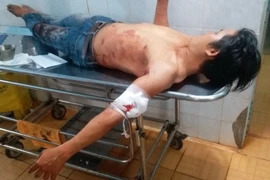 Kiệt đang được cấp cứu ở bệnh viện. (Ảnh: Đậu Tất Thành/Vietnam+)