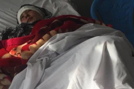 Zarina bị chồng cắt cả hai tai. (Nguồn: BBC)