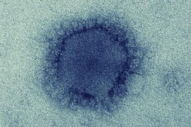 Hội chứng hô hấp ở Trung Đông MERS-CoV. (Nguồn: cidrap.umn.edu)