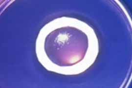 Giác mạc nhân tạo. (Nguồn: Internet)