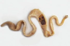 Ảnh minh họa. (Nguồn: Internet)