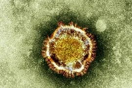 (Nguồn: au.ibtimes)