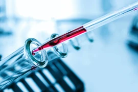 Ảnh chỉ mang tính minh họa. (Nguồn: Vermont)