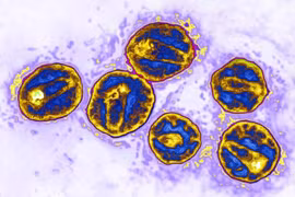 Ca bệnh thứ 3 trên thế giới khỏi HIV/AIDS nhờ cấy ghép tế bào gốc