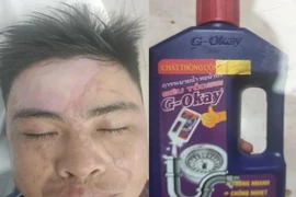 Nổ lớn khi dùng nước thông cống cho bồn cầu, một người bị bỏng nặng