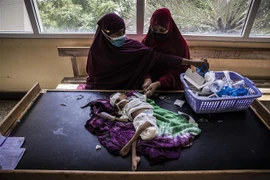 Nhân viên y tế điều trị cho em nhỏ bị suy dinh dưỡng tại bệnh viện ở Mogadishu, Somalia. (Ảnh: AFP/TTXVN)